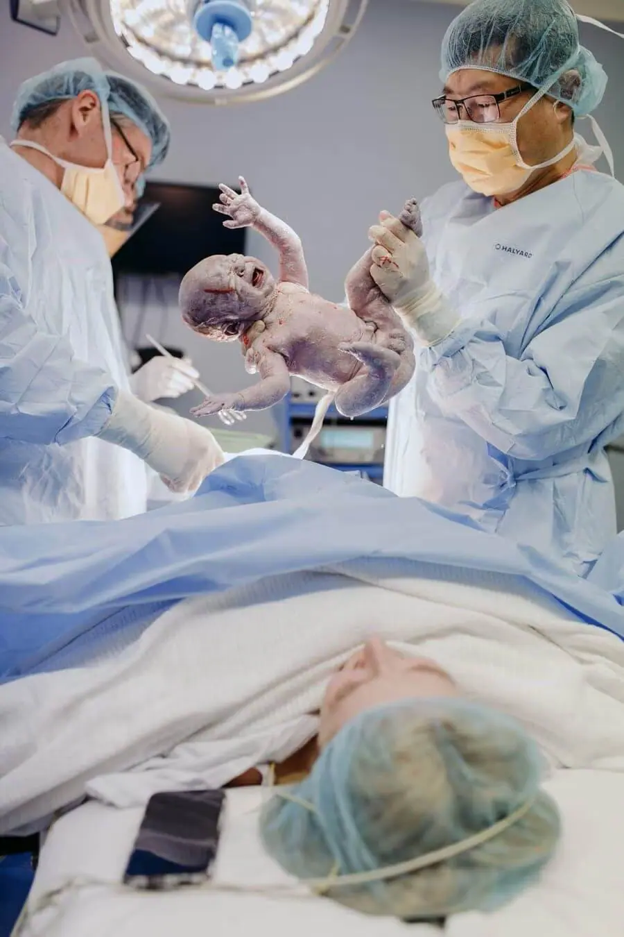 Medical staff lifting a newborn baby above blue surgical drapes.